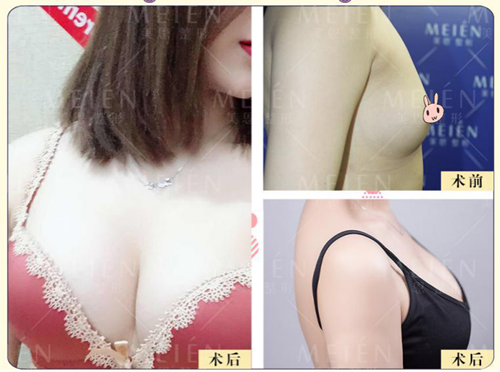 1575255598849299.png 图片3.png
